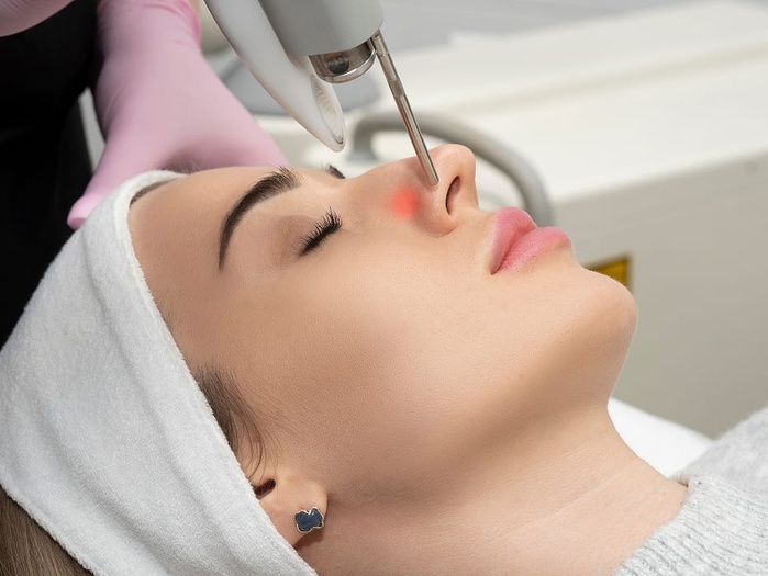 PEELING 6D® LASER - Zabiegi - Ciało